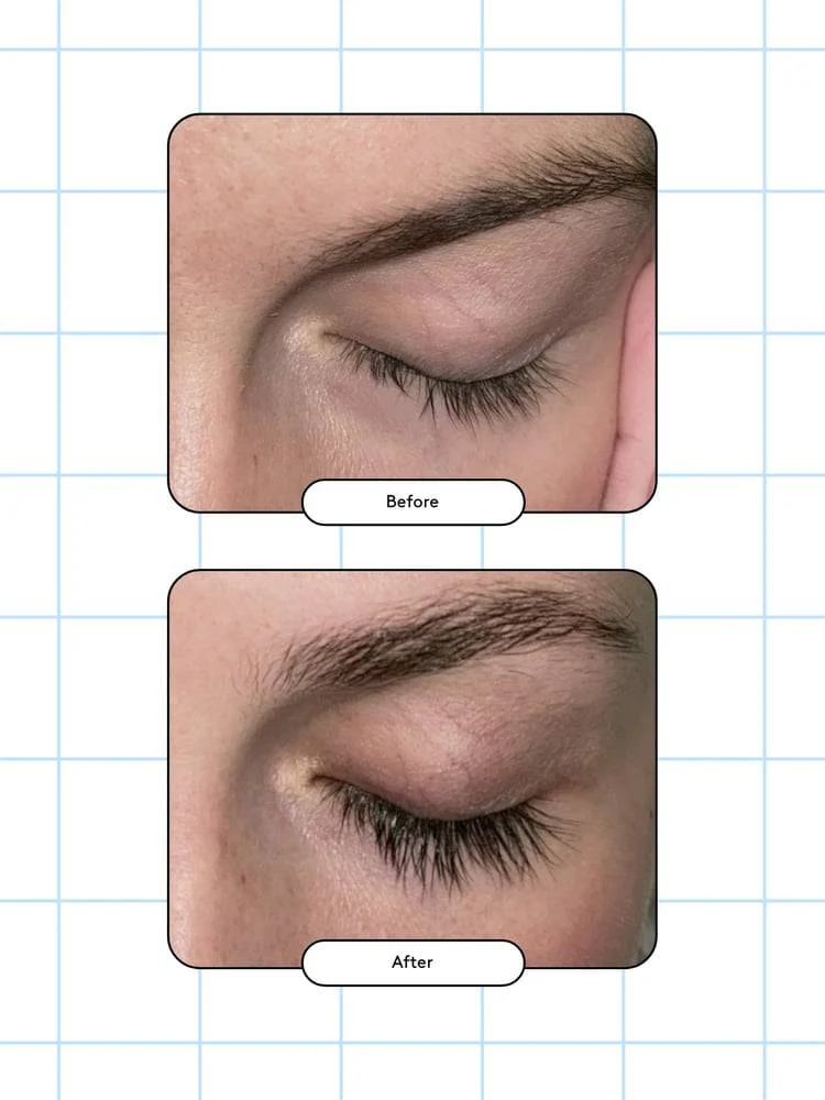 Xlash Eyelash Growth Serum (3ml or 5ml) - Image 4