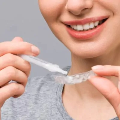 Teeth Whitening - BRONZE