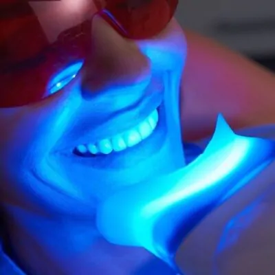 Teeth Whitening - SILVER