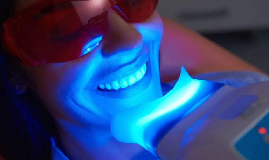 Teeth Whitening - SILVER