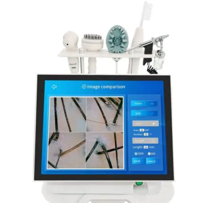 Scalp Scope Pro - with before and afters