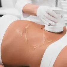 Fat Cavitation And Body Sculpting